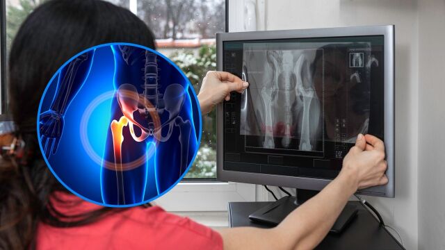 Снимка: Какво е дисплазия: Това рак ли е и как се лекува