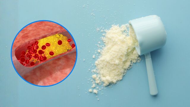 Снимка: Може ли суроватъчният протеин да понижи холестерола?