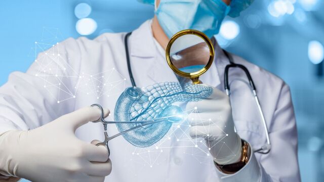 Снимка: Какво е панкреас дивизум: Вродена аномалия, която 90% от хората не подозират