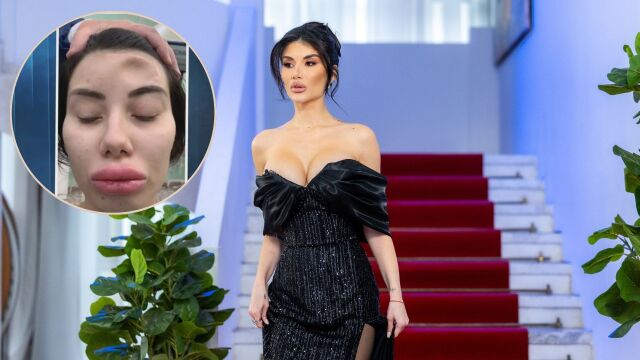 Снимка: След тежка катастрофа и титаниева пластина в черепа - Пламена влиза в „Ергенът“ (СНИМКИ)