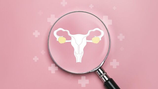 Снимка: 5 симптома на кисти на яйчниците, които всяка жена трябва да познава