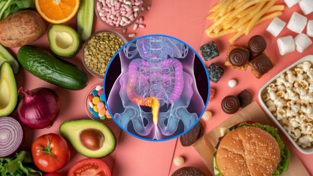 Снимка: Най-добрите и най-лошите храни при хемороиди