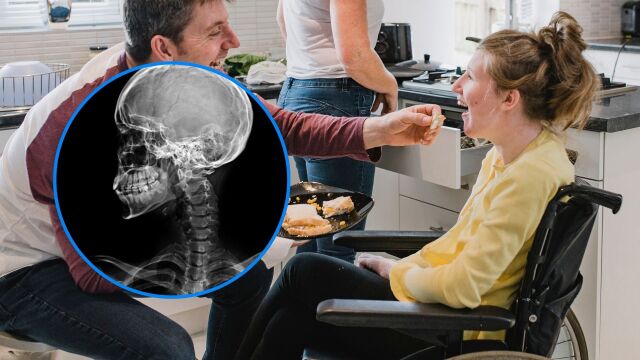 Снимка: Какво е Синдром на Неймеген: Рядко генетично заболяване с висок риск към рак