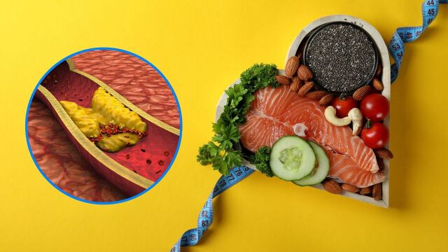 Снимка: 7 храни за понижаване на холестеролa