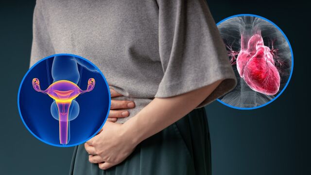 Снимка: Поликистозните яйчници увеличават сърдечно-съдовия риск с до 40%