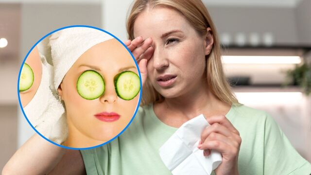 Снимка: 8 доказани домашни средства при подпухнали от плач очи