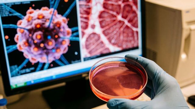 Снимка: „Живи лекарства“ могат да направят лечението на рак по-евтино и достъпно