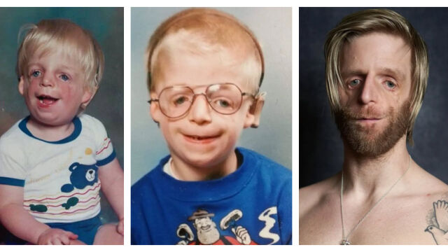 Снимка: Джоно – как бебето, което никой не искаше, се превърна в мъжа, който вдъхновява хиляди (СНИМКИ)