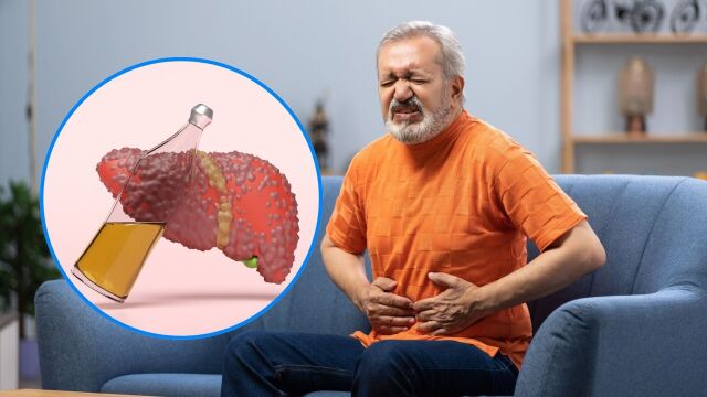 Снимка: Може ли да се излекува цирозата: Има ли начин да я контролираме