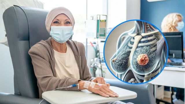 Снимка: Нов тест показва кое лечение на рак на гърдата е най-ефективно