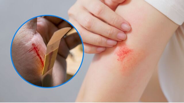 Снимка: Раната ви не заздравява: Може да е заради цигари, алкохол или рак