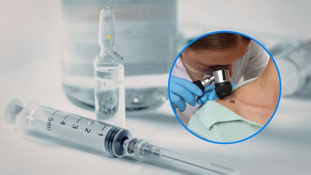 Снимка: Ваксина срещу меланом намалява риска от смърт с 49% при рак на кожата