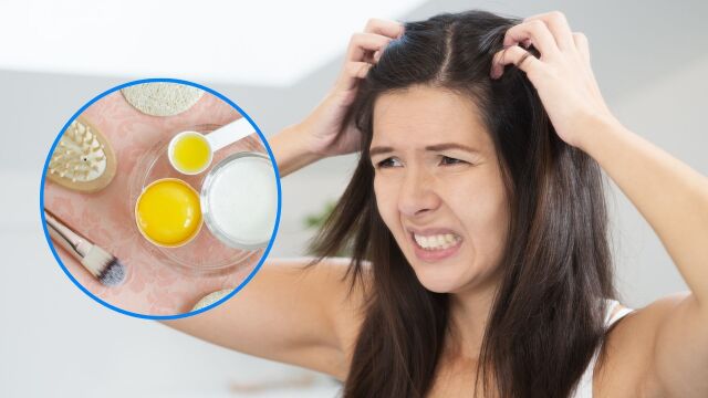 Снимка: Сух и сърбящ скал: 11 природни начина за лечение