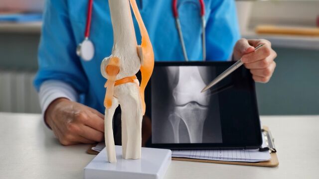 Снимка: Коксартроза и артроза, защо не бива да отлагаме прегледа на ставите?