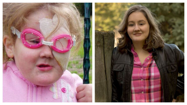 Снимка: Какво е да живееш, без да изпитваш никаква болка – историята на Габи Гинграс