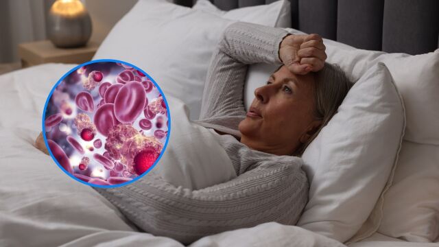 Снимка: Нощно изпотяване: Ранен симптом на рак на кръвта