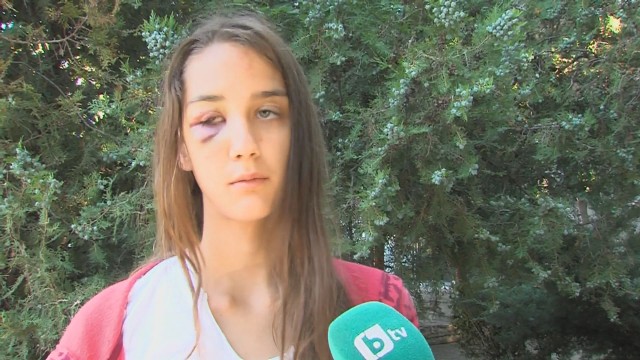 Снимка: Необяснима агресия: Мъж от Несебър преби 13-годишно момиче посред бял ден