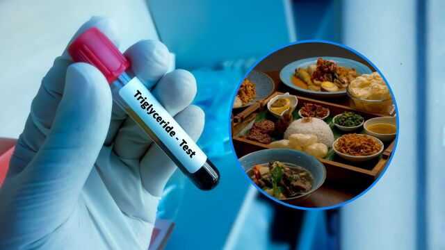 Снимка: Храни, които да избягвате при високи триглицериди