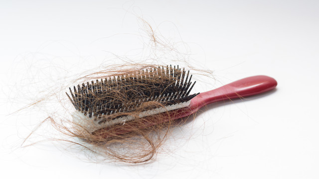 Снимка: Чиста ли е четката ви за коса? Ето защо не трябва да пропускате да я миете