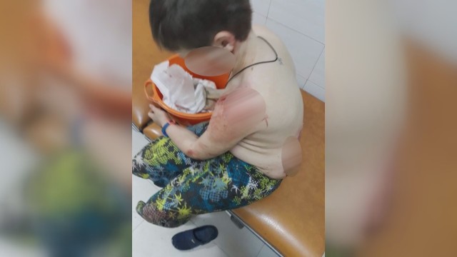 Снимка: Прокурорска проверка по случая с нахапаното от куче 10-годишно дете