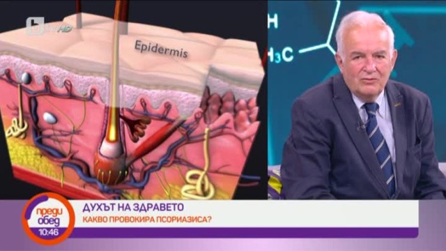Снимка: Духът на здравето: Модерни начини за лечение на псориазис