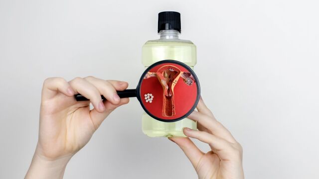 Снимка: Някои козметични продукти могат да увеличат риска от ендометриоза