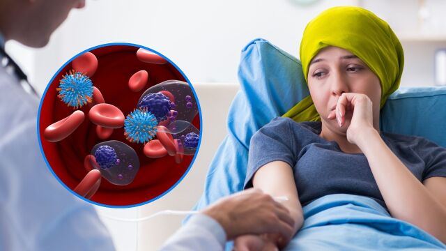 Снимка: Множествен миелом: Какви са усложненията от рака на костния мозък