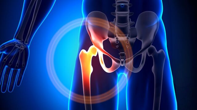 Снимка: 7 причини за болка в тазобедрената става