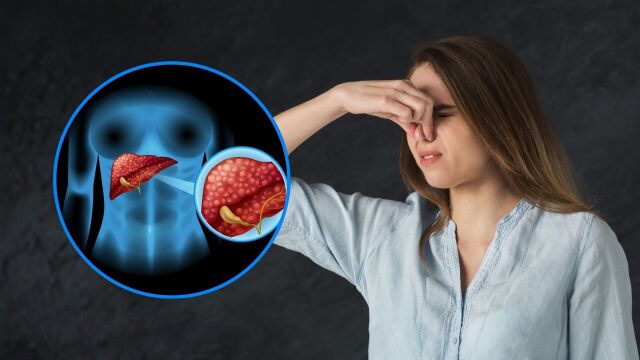 Снимка: Кога плодовият дъх показва здравословен проблем?