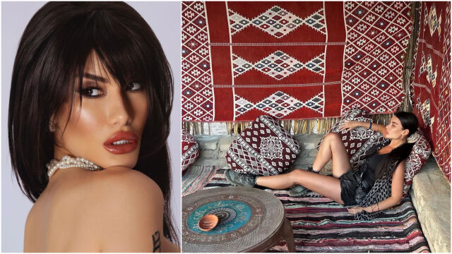 Снимка: Пламена от „Ергенът“: Преди и след операциите, на които се подлага (СНИМКИ)