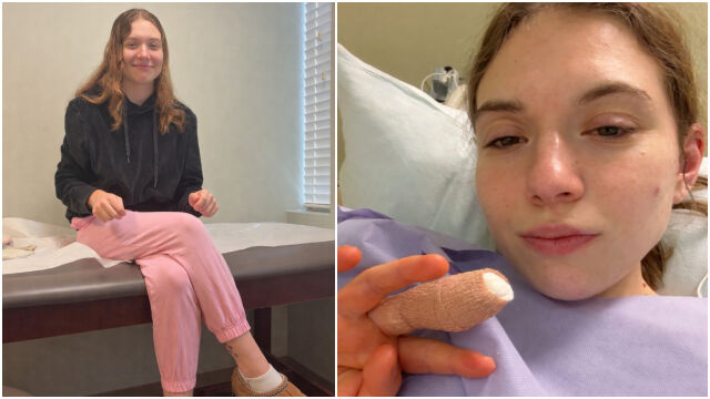 Снимка: Кожички около ноктите: 21-годишно момиче едва не се сбогува с пръста си (ВИДЕО) 