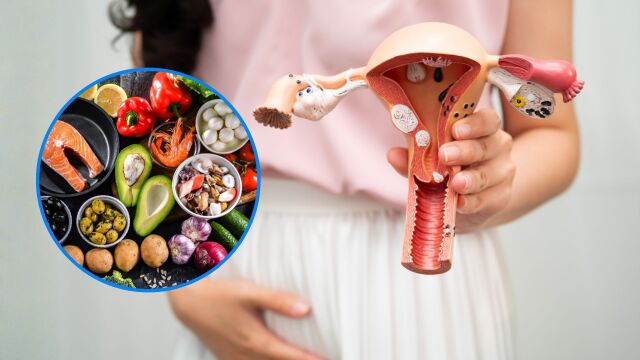 Снимка: Влияе ли диетата върху риска от рак на шийката на матката?