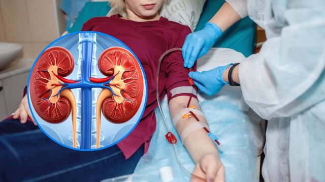 Снимка: Бъбречни заболявания: Защо хората на диализа в България се увеличават