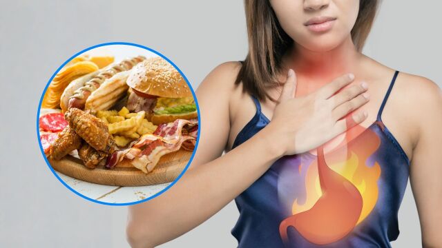 Снимка: Киселини в стомаха: 9-те най-лоши храни, които ги причиняват