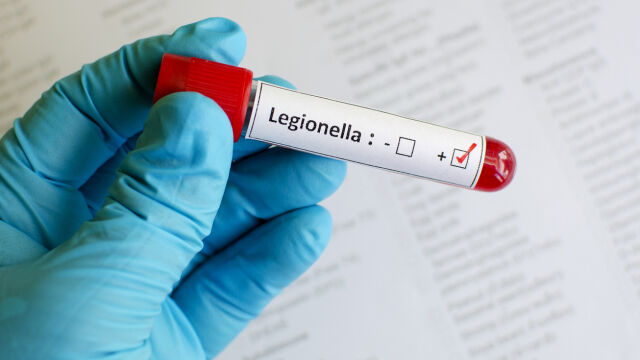 Снимка: Бургазлийка се зарази с легионерска болест в Турция и почина след завръщането си