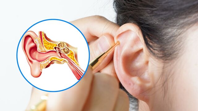 Снимка: Рак на ухото: Може ли да се лекува рядкото заболяване