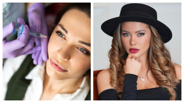 Снимка: Жена загубила живота си заради филъри. Горчивият опит на една участничка от „Ергенът“ 