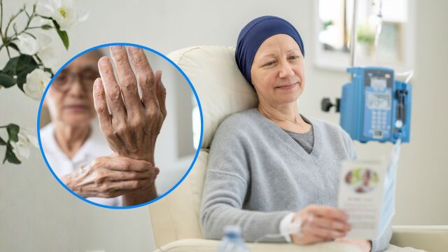 Снимка: Периферна невропатия след химиотерапия: Най-добрите средства за лечение