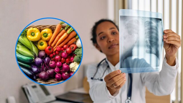Снимка: 19 храни подобряват здравето на белите дробове