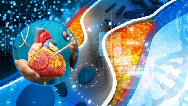 Снимка: Все повече млади хора с висок холестерол приемат статини още на 30 г.