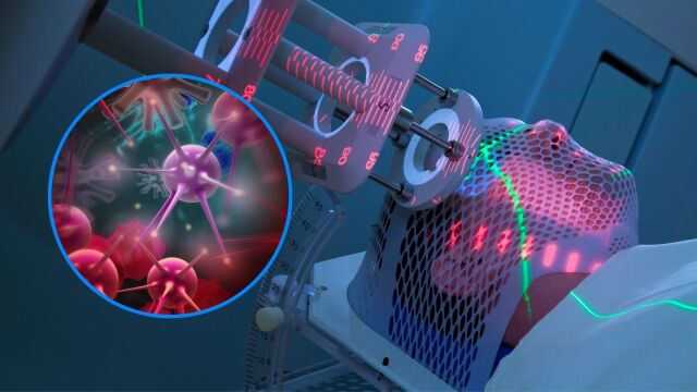 Снимка: Учени откриват по-безопасен метод за лечение на рак с радиотерапия