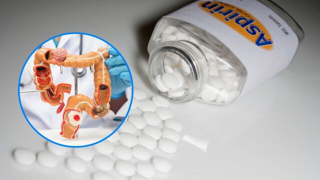 Снимка: Ежедневният прием на аспирин намалява ли риска от рак на дебелото черво?