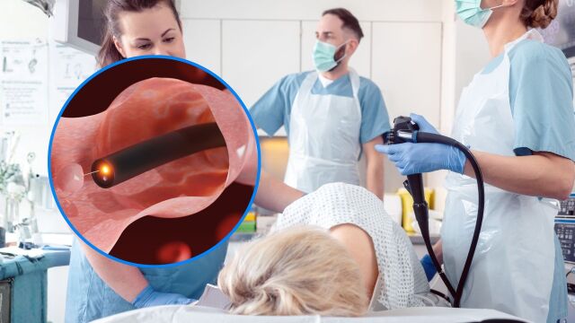 Снимка: Рискове от колоноскопия: В кои случаи не се прави