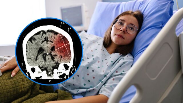 Снимка: Инсулт при деца и тийнейджъри: Как да го разпознаете и как се лекува