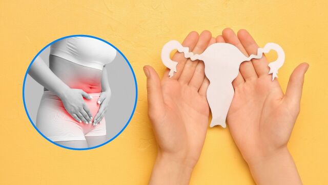 Снимка: 6 мита за ендометриозата: Какво казват специалистите?