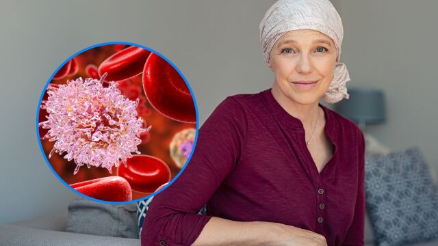 Снимка: Кой вид рак се развива най-бавно?