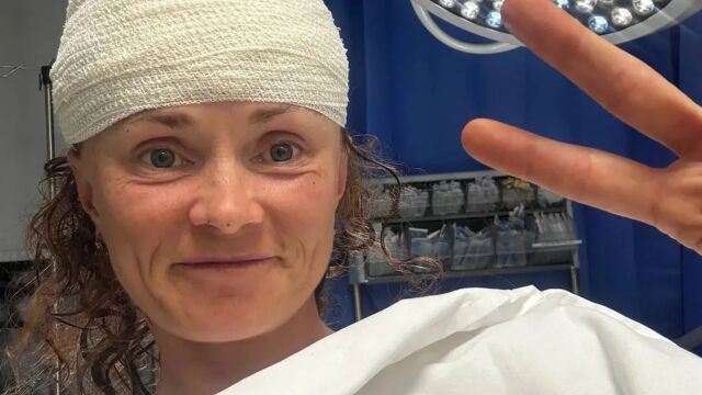 Снимка: Три кучета нападнаха лекоатлетка (СНИМКИ)