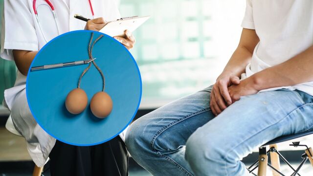 Снимка: Може ли вазектомията да повиши риска от рак