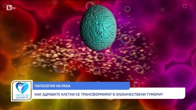 Снимка: Канцерогенеза: Как стартира едно онкологично заболяване? (ВИДЕО)