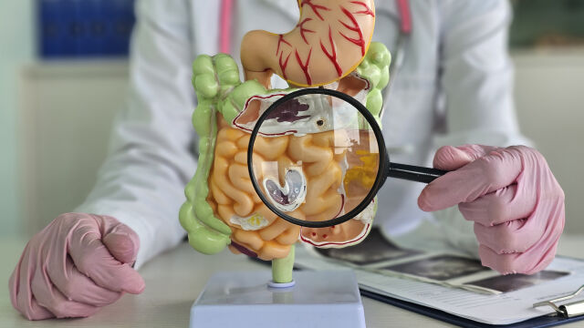 Снимка: Раздразнено дебело черво: Симптоми, които не трябва да игнорирате